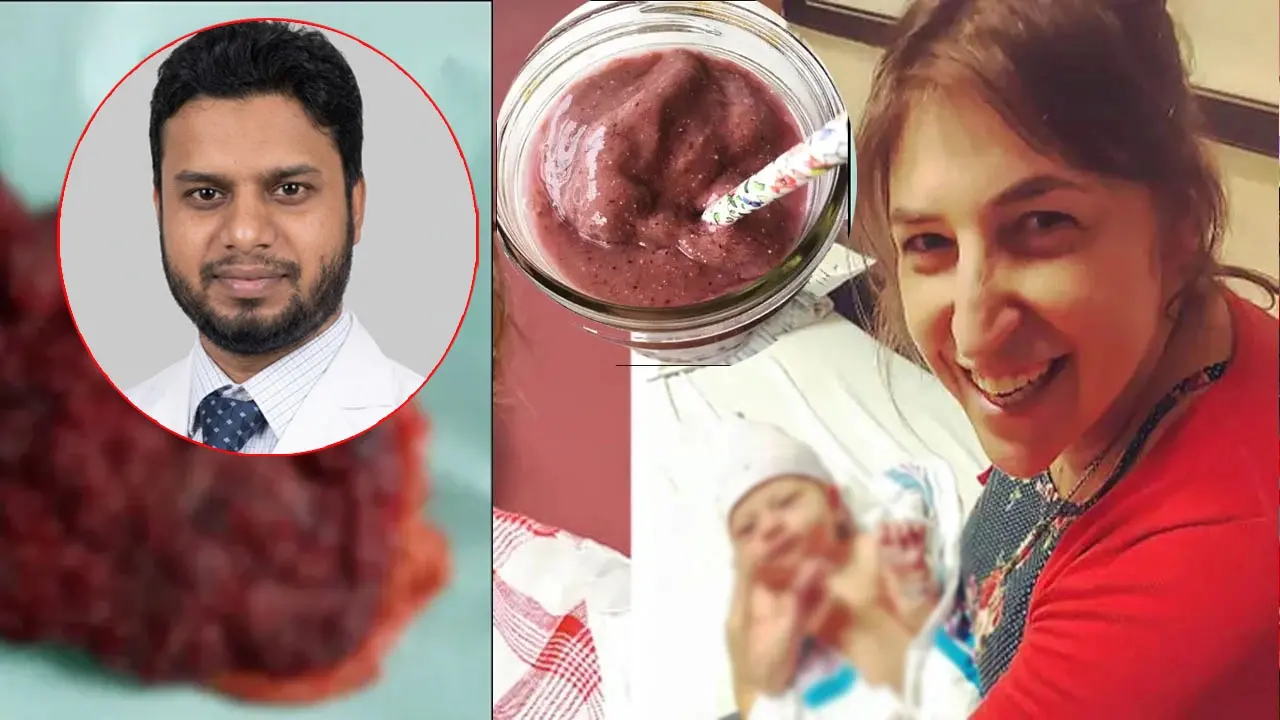 নারীদের গর্ভফুল দিয়ে কি সত্যিই ওষুধ তৈরি হয়, যা বলছেন চিকিৎসকরা - Chief TV