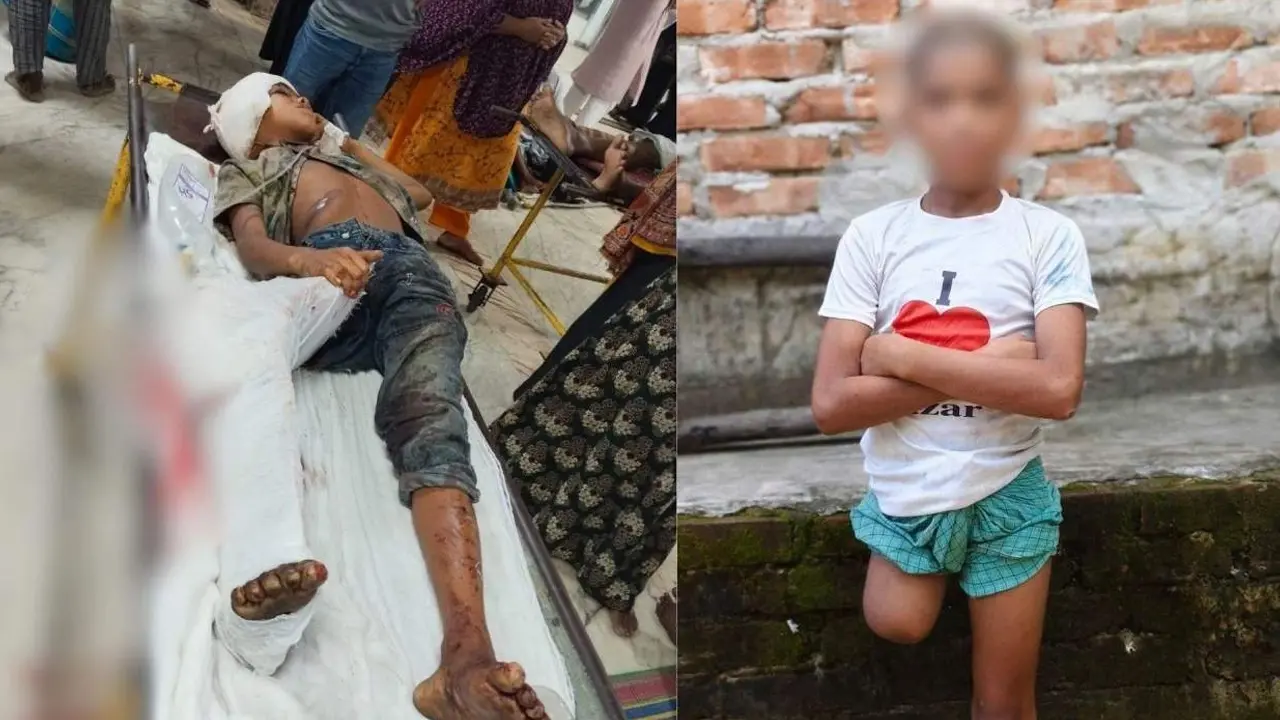 ট্রেন দুর্ঘটনার কারণে পা কাটতে হয়েছিল সেই রায়হানের - Chief TV
